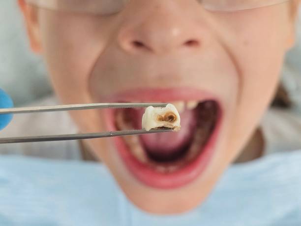 Best Emergency Treatment for Toothache in Carnesville, GA